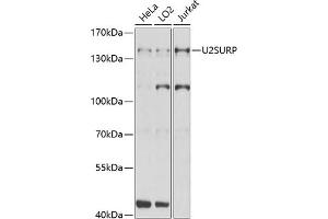 Western blot analysis of extracts of various cell lines, using U2SURP Antibody (ABIN6132839, ABIN6149759, ABIN6149760 and ABIN6220240) at 1:1000 dilution. (SR140 Antikörper  (AA 705-1029))