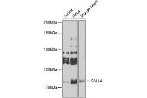 Western blot analysis of extracts of various cell lines, using SALL4 Antibody (ABIN6132627) at 1:1000 dilution. (SALL4 Antikörper  (AA 1-220))