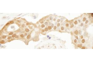 Immunohistochemistry (IHC) image for anti-Parkinson Protein 7 (PARK7) (C-Term) antibody (ABIN7448532)