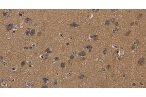 Immunohistochemistry of paraffin-embedded Human brain using CD242 Polyclonal Antibody at dilution of 1:50 (ICAM4 Antikörper)