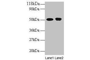 Western blot All lanes: ODC1 antibody at 2 μg/mL Lane 1: EC109 whole cell lysate Lane 2: 293T whole cell lysate Secondary Goat polyclonal to rabbit IgG at 1/15000 dilution Predicted band size: 52 kDa Observed band size: 52 kDa (ODC1 Antikörper  (AA 1-461))