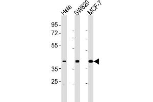 All lanes : Anti-HPN Antibody (Center) at 1:2000 dilution Lane 1: Hela whole cell lysates Lane 2: S whole cell lysates Lane 3: MCF-7 whole cell lysates Lysates/proteins at 20 μg per lane. (Hepsin Antikörper  (AA 153-188))