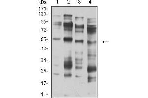Western Blotting (WB) image for anti-Cholinergic Receptor, Nicotinic, alpha 5 (Neuronal) (CHRNA5) (AA 23-254) antibody (ABIN5611355)