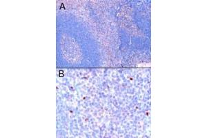 ABIN184677 (1µg/ml) staining of paraffin embedded Human Tonsil. (FOXP3 Antikörper  (C-Term))