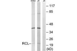 Western Blotting (WB) image for anti-Chromosome 6 Open Reading Frame 108 (C6orf108) (AA 1-50) antibody (ABIN2890227) (RCL Antikörper  (AA 1-50))