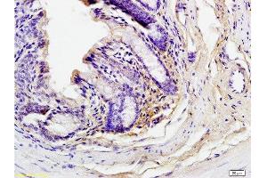 Formalin-fixed and paraffin embedded mouse small intestine tissue labeled with Anti-Phospho-GCN2 (Thr898) Polyclonal Antibody, Unconjugated  at 1:200 followed by conjugation to the secondary antibody and DAB staining (GCN2 Antikörper  (pThr899))