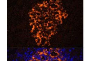 Immunofluorescence analysis of Rat pancreas using PNLIPRP2 Polyclonal Antibody at dilution of 1:100. (PNLIPRP2 Antikörper)