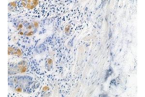 ABIN6265571 and ABIN6279871 at 1/100 staining human normal gastric tissue by IHC-P.