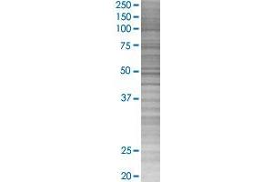 ADRB2 transfected lysate.