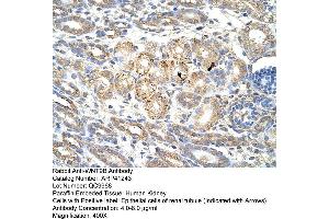 Immunohistochemistry (IHC) image for anti-Wingless-Type MMTV Integration Site Family, Member 9B (WNT9B) (C-Term) antibody (ABIN2776704)