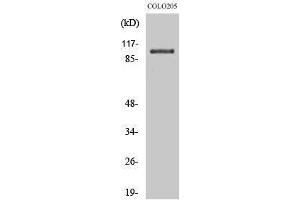 Western Blotting (WB) image for anti-Oculocerebrorenal Syndrome of Lowe (OCRL) (Internal Region) antibody (ABIN3176438) (OCRL Antikörper  (Internal Region))