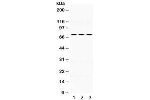 Western blot testing of human 1) HeLa, 2) MCF7 and 3) SW620 lysate wtih KEAP1 antibody. (KEAP1 Antikörper  (AA 25-205))