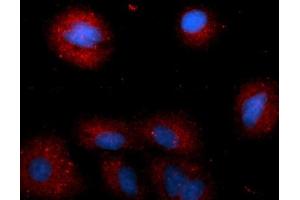 Immunofluorescence (IF) image for anti-Cathepsin E (CTSE) (AA 57-363) antibody (PE) (ABIN5565234)