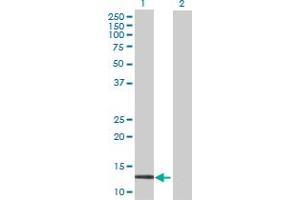 Western Blot analysis of CALML3 expression in transfected 293T cell line by CALML3 MaxPab polyclonal antibody.
