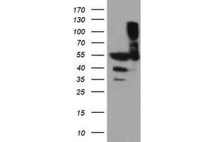 Western Blotting (WB) image for anti-Tubulin, alpha-Like 3 (TUBAL3) (AA 150-446) antibody (ABIN1490951) (TUBAL3 Antikörper  (AA 150-446))