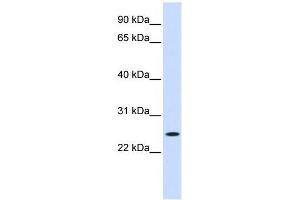 Western Blot showing NOL3 antibody used at a concentration of 1-2 ug/ml to detect its target protein. (NOL3 Antikörper  (Middle Region))