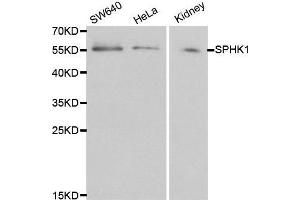Western blot analysis of extracts of various cell lines, using SPHK1 antibody. (SPHK1 Antikörper  (AA 50-384))