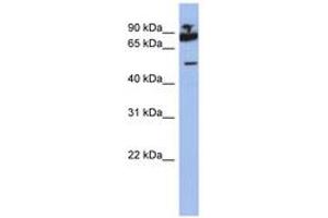 Image no. 1 for anti-IKAROS Family Zinc Finger 1 (Ikaros) (IKZF1) (AA 395-444) antibody (ABIN6742315) (IKZF1 Antikörper  (AA 395-444))