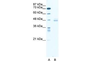 WB Suggested Anti-LDB1 Antibody Titration:  0. (LIM Domain Binding 1 Protein Antikörper  (Middle Region))
