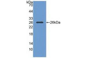 Western Blotting (WB) image for anti-RAS P21 Protein Activator (GTPase Activating Protein) 1 (RASA1) (AA 403-596) antibody (ABIN7443047)