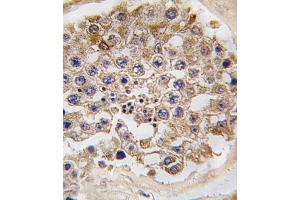 Formalin-fixed and paraffin-embedded human testis tissue reacted with FRp, which was peroxidase-conjugated to the secondary antibody, followed by DAB staining. (MTOR Antikörper  (AA 2459-2488))