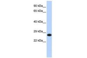 Image no. 1 for anti-Proteasome Subunit alpha 2 (PSMA2) (AA 36-85) antibody (ABIN6741386) (PSMA2 Antikörper  (AA 36-85))