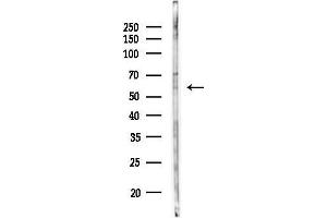 Western blot analysis of lysates from COLO205 cells, using Phospho-Caspase 8 (Ser347) Antibody at 1/1000 dilution.
