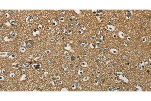 Immunohistochemistry of paraffin-embedded Human brain using NEMF Polyclonal Antibody at dilution of 1:30 (NEMF Antikörper)