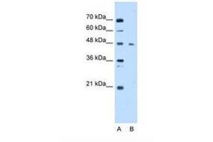 Image no. 1 for anti-Enolase 3 (Beta, Muscle) (ENO3) (AA 21-70) antibody (ABIN6738428) (ENO3 Antikörper  (AA 21-70))