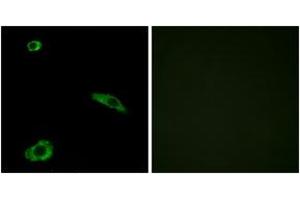 Immunofluorescence analysis of MCF7 cells, using ACTHR Antibody.