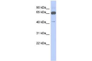 WB Suggested Anti-ZNF446 Antibody Titration:  0. (ZNF446 Antikörper  (N-Term))