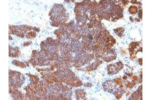 Formalin-fixed, paraffin-embedded human parathyroid stained with PTH antibody (PTH/1174). (PTH Antikörper  (AA 32-115))