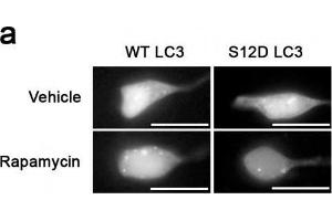 Something like SH-SY5Y cells expressing GFP-LC3-WT or-S12D treated with rapamycin or vehicle for 1h.