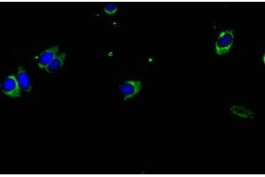 Immunofluorescent analysis of Hela cells using ABIN7155581 at dilution of 1:100 and Alexa Fluor 488-congugated AffiniPure Goat Anti-Rabbit IgG(H+L) (HLA-DPA1 Antikörper  (AA 29-222))