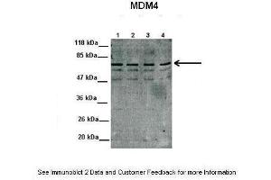 Lanes:  1. (MDM4-binding Protein Antikörper  (N-Term))