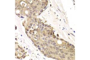 Immunohistochemistry (Paraffin-embedded Sections) (IHC (p)) image for anti-FK506 Binding Protein 4, 59kDa (FKBP4) (AA 220-459) antibody (ABIN6140658)
