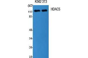 Western Blot (WB) analysis of specific cells using HDAC5 Polyclonal Antibody. (HDAC5 Antikörper  (Tyr512))