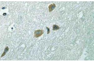 Immunohistochemistry (IHC) analyzes of ILK antibody in paraffin-embedded human brain tissue. (ILK Antikörper)