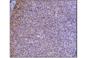 IHC analysis of Prolyl Endopeptidase/PREP using anti-Prolyl Endopeptidase/PREP antibody (ABIN7599118). (PREP Antikörper  (AA 1-227))