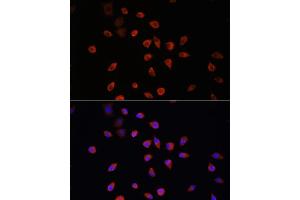 Immunofluorescence analysis of L929 cells using IFT88 antibody (ABIN6131798, ABIN6142226, ABIN6142227 and ABIN6216899) at dilution of 1:100. (IFT88 Antikörper  (AA 534-833))