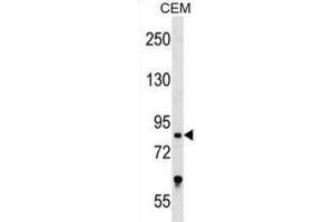 Western Blotting (WB) image for anti-Transcription Factor 25 (Basic Helix-Loop-Helix) (TCF25) antibody (ABIN2999343) (TCF25 Antikörper)