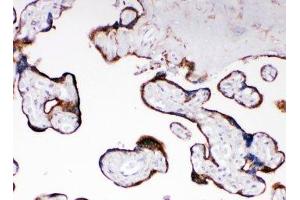IHC-P: CYPOR antibody testing of human placenta tissue