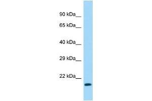 Host:  Rabbit  Target Name:  Naa40  Sample Type:  Mouse Stomach lysates  Antibody Dilution:  1. (NAA40 Antikörper  (C-Term))