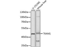 Western blot analysis of extracts of various cell lines, using TRAM1 antibody (ABIN6291640) at 1:1000 dilution. (TRAM1 Antikörper)