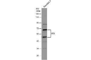 WB Image Whole cell extract (30 μg) was separated by 10% SDS-PAGE, and the membrane was blotted with ST2 antibody [N1C1] , diluted at 1:500. (IL1RL1 Antikörper)
