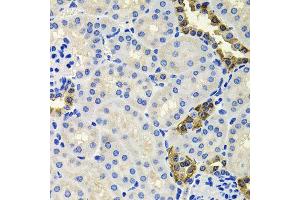 Immunohistochemistry of paraffin-embedded mouse kidney using CALB2 antibody (ABIN6003539) at dilution of 1/100 (40x lens). (Calretinin Antikörper)