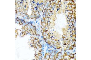 Immunohistochemistry of paraffin-embedded mouse testis using STIP1 Rabbit mAb (ABIN1512566, ABIN3020619, ABIN3020620 and ABIN7101303) at dilution of 1:100 (40x lens). (STIP1 Antikörper)