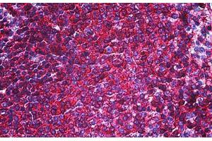 Human Spleen: Formalin-Fixed, Paraffin-Embedded (FFPE) (CD44 Antikörper)