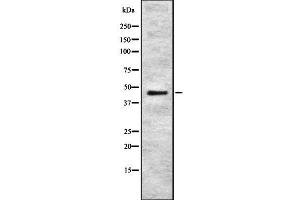 Western blot analysis of RELT using HuvEc whole cell lysates (RELT Antikörper  (C-Term))