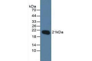 Detection of MGMT in Human Jurkat Cells using Polyclonal Antibody to O-6-Methylguanine DNA Methyltransferase (MGMT) (MGMT Antikörper  (AA 1-207))